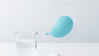 An illustration of the Elipse swallowable gastric balloon in both its pill-sized capsule form and its inflated state within the stomach.