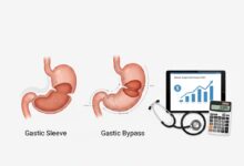 An illustration comparing gastric sleeve and gastric bypass surgeries next to a calculator and stethoscope for cost comparison.