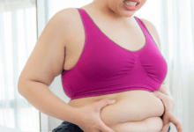 Bariatric Surgery Cost