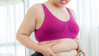 Bariatric Surgery Cost