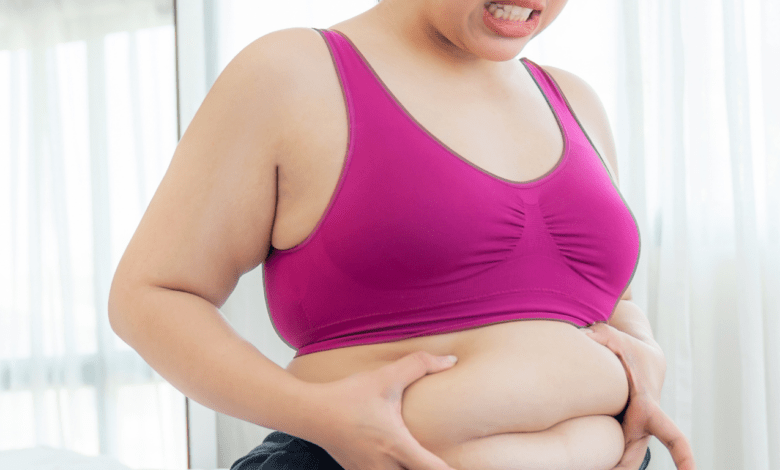 Bariatric Surgery Cost