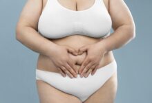 gastric bypass surgery recovery time