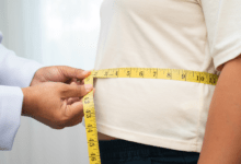 BMI requirements for surgery