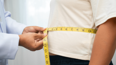 BMI requirements for surgery