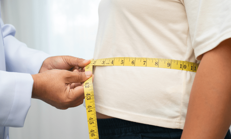 BMI requirements for surgery