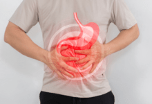 Gastric Pouch