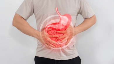 Gastric Pouch