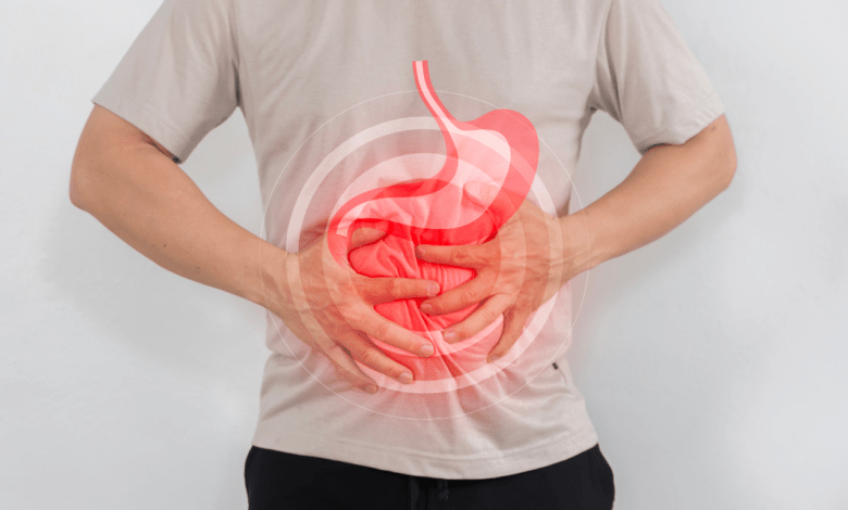 Gastric Pouch