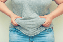 Gastric bypass