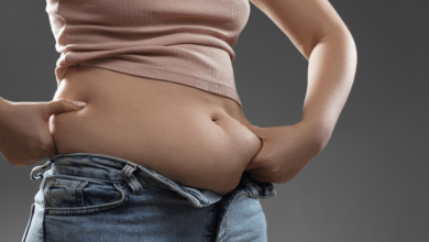 Gastric band