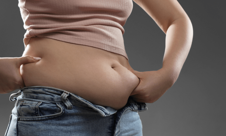 Gastric band