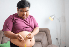 Gastric sleeve