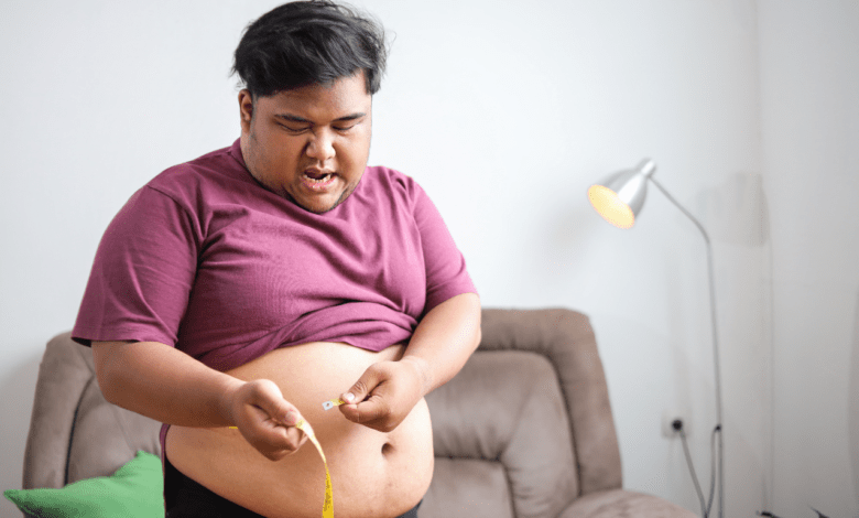 Gastric sleeve