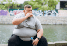 Bariatric surgery consultation