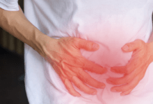Hernia repair