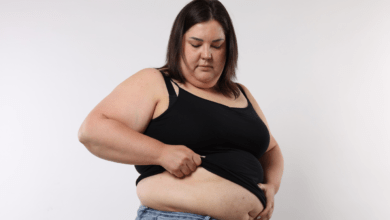 Weight loss surgery