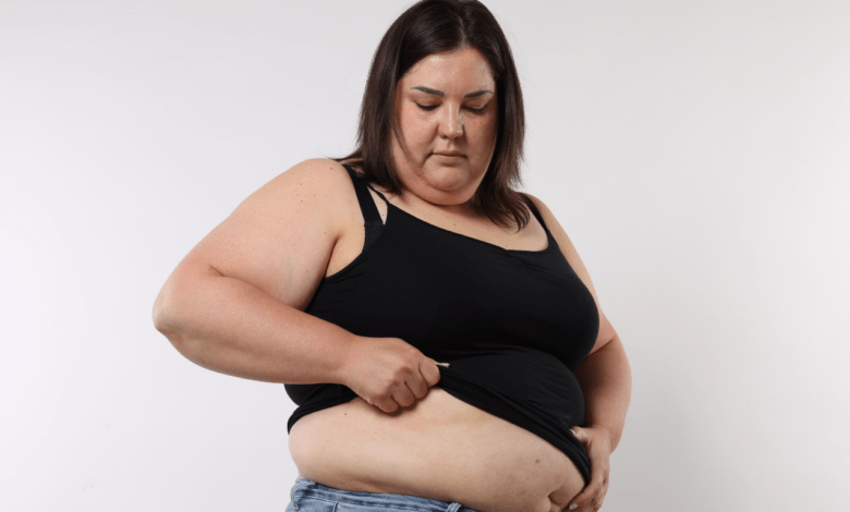 Weight loss surgery