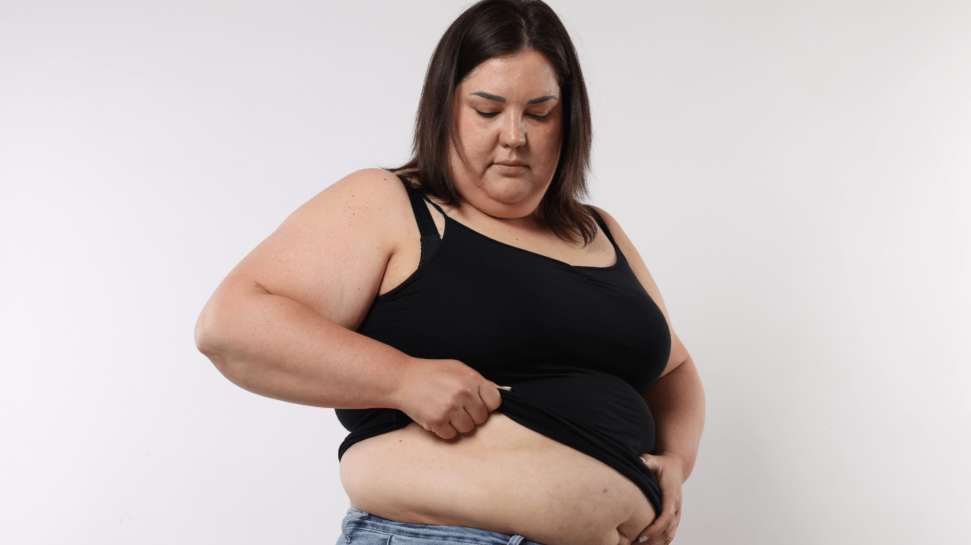 Weight loss surgery