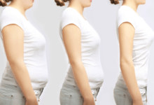 gastric bypass