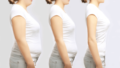 gastric bypass