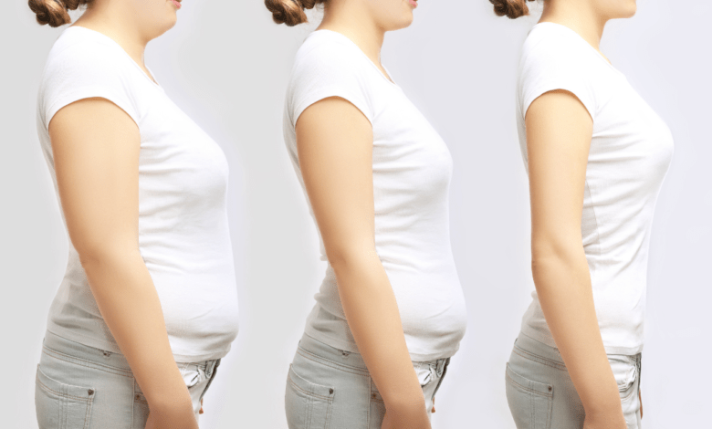 gastric bypass